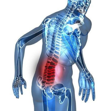 aree del corpo che possono avere benefici con l'ozonoterapia: schiena
